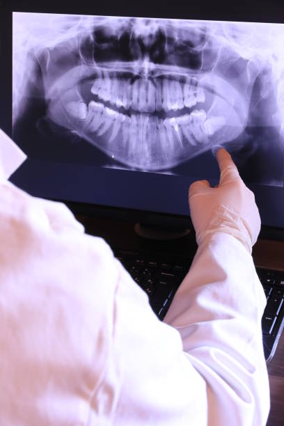 Best Emergency Tooth Extraction in Burney, CA