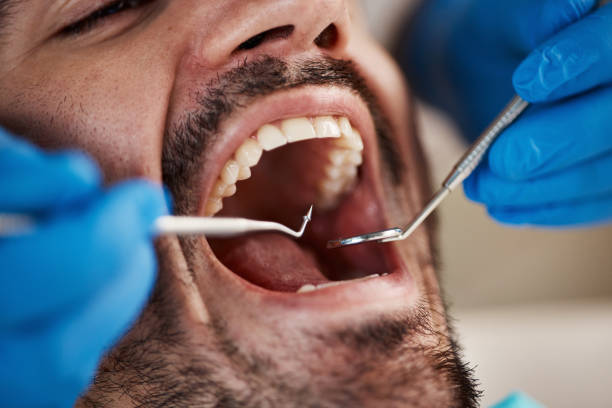 Best Weekend Emergency Dentist in Burney, CA